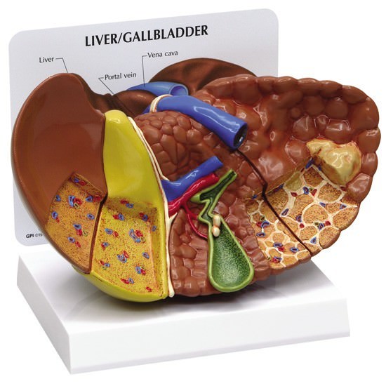 Liver Cancer GPI Anatomical Model w Key LFA #3310. Make Us an Offer! SEE VIDEO
