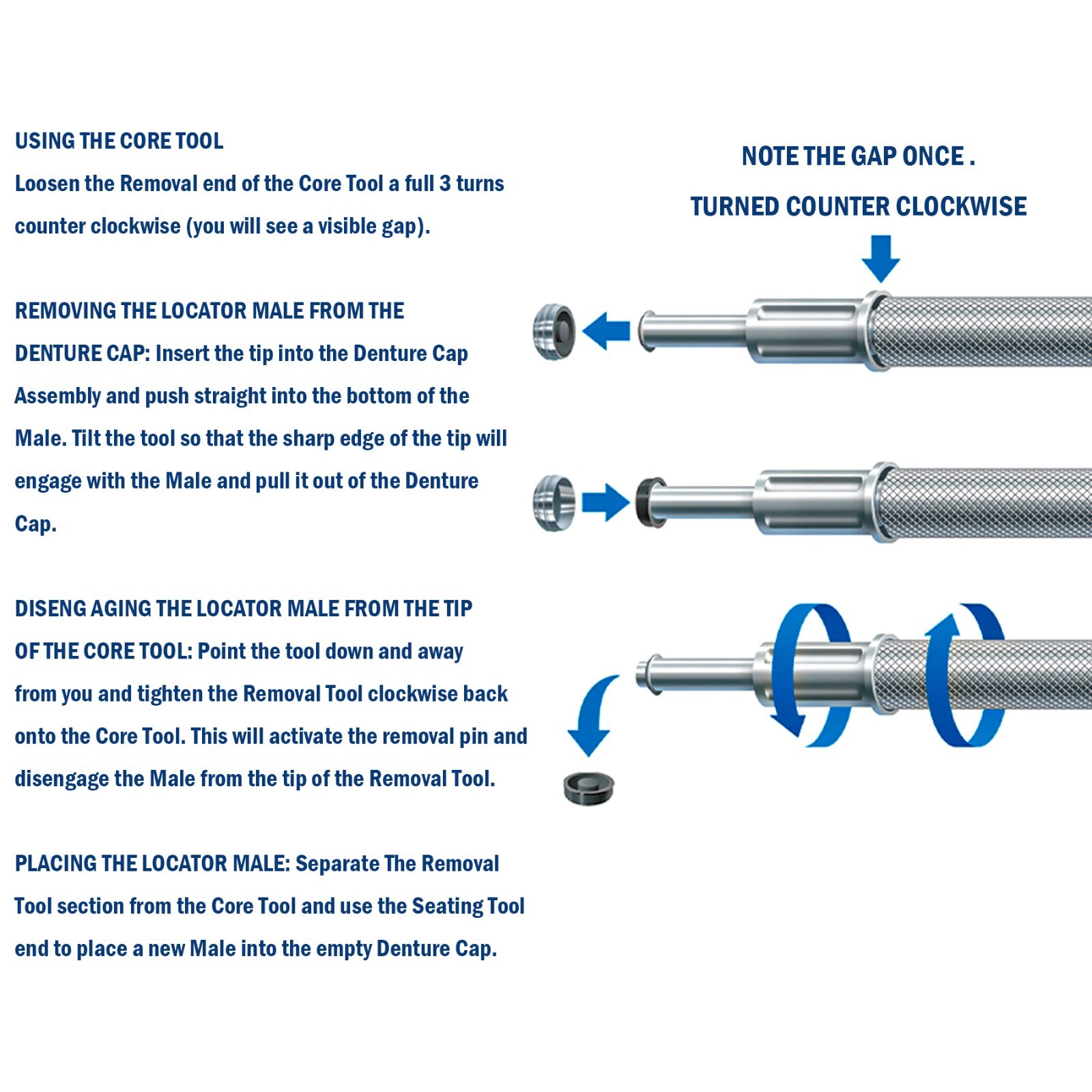 US Locator Tapered System Abutment/Caps for Hiossen Zimmer Nobel Overdenture