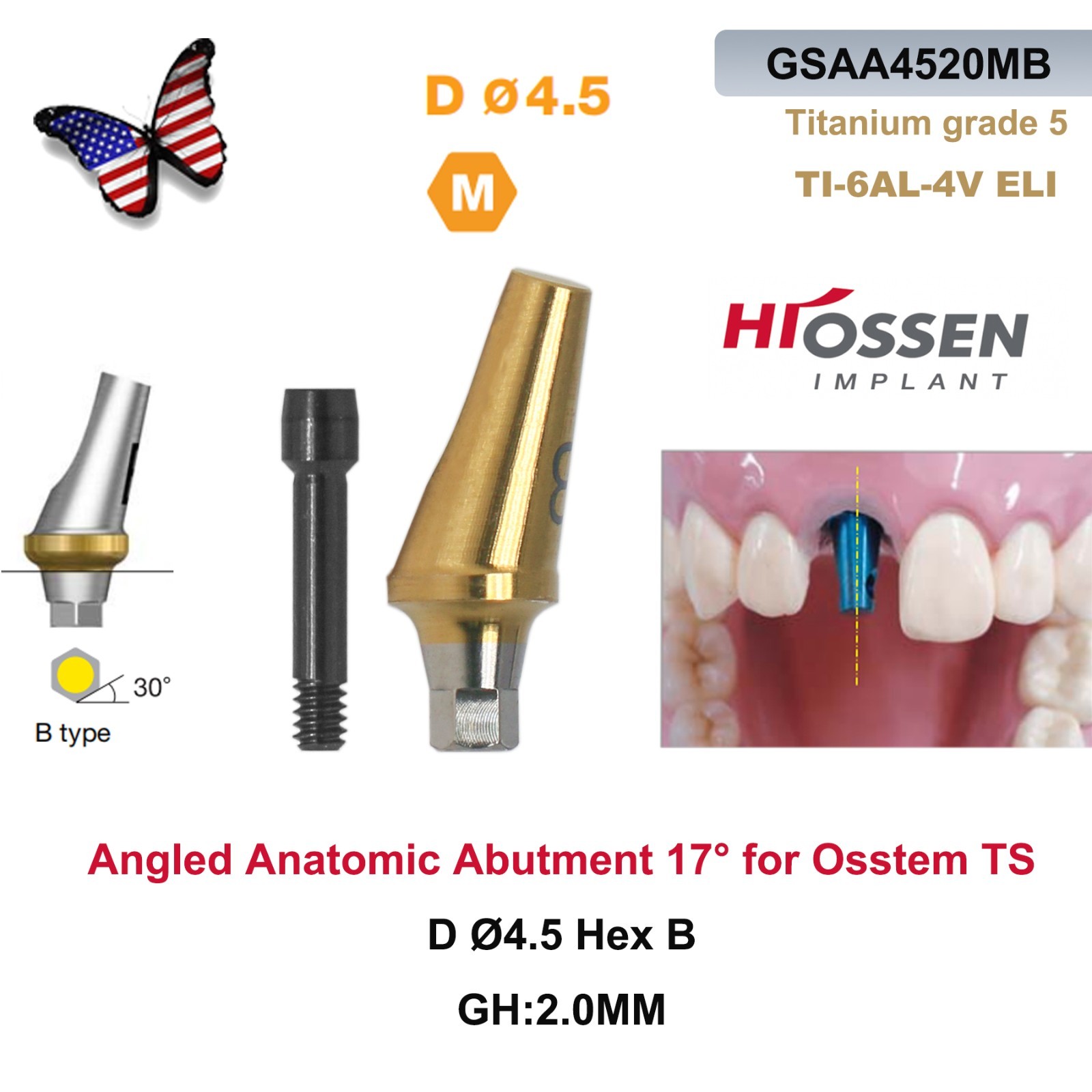US 17° Angulated Abutment Mini Hex for Osstem TS Mini NP Platform Titanium Screw