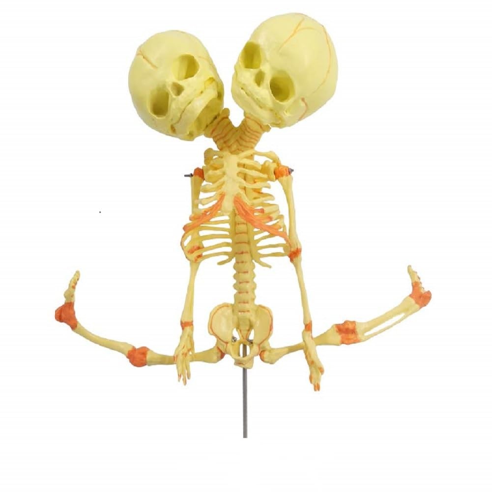 EVOTECH SCIENTIFIC Human Infant Skeleton Model, Twin-Skull, Miniature
