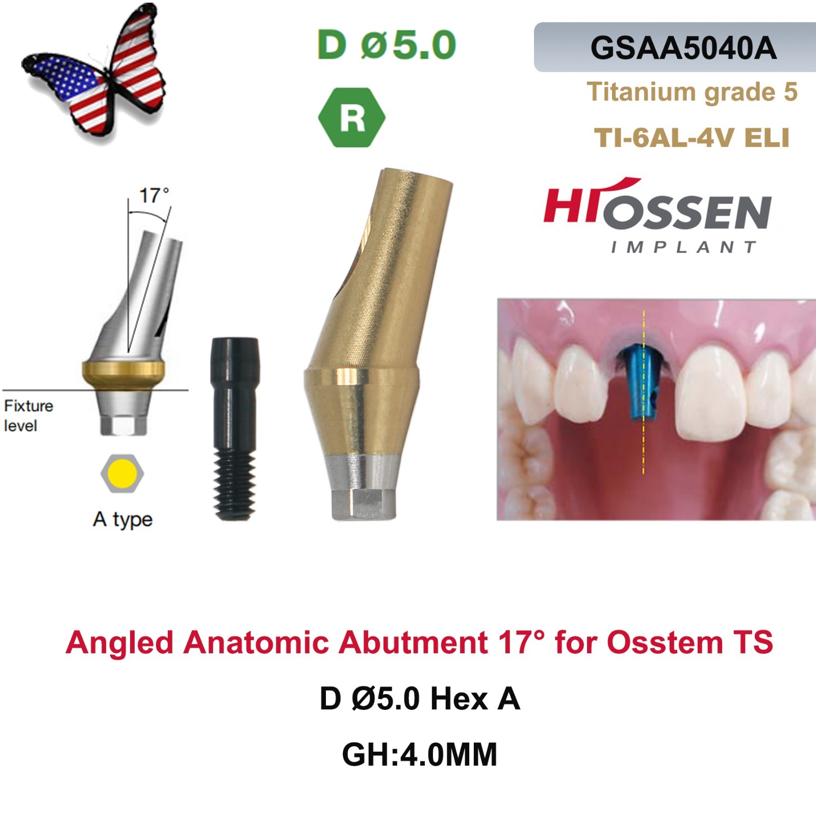 Dental 17° Angled Abutment Regular Ø5.0mm Hex A/B GH2/4 Fit Osstem TS Hiossen ET
