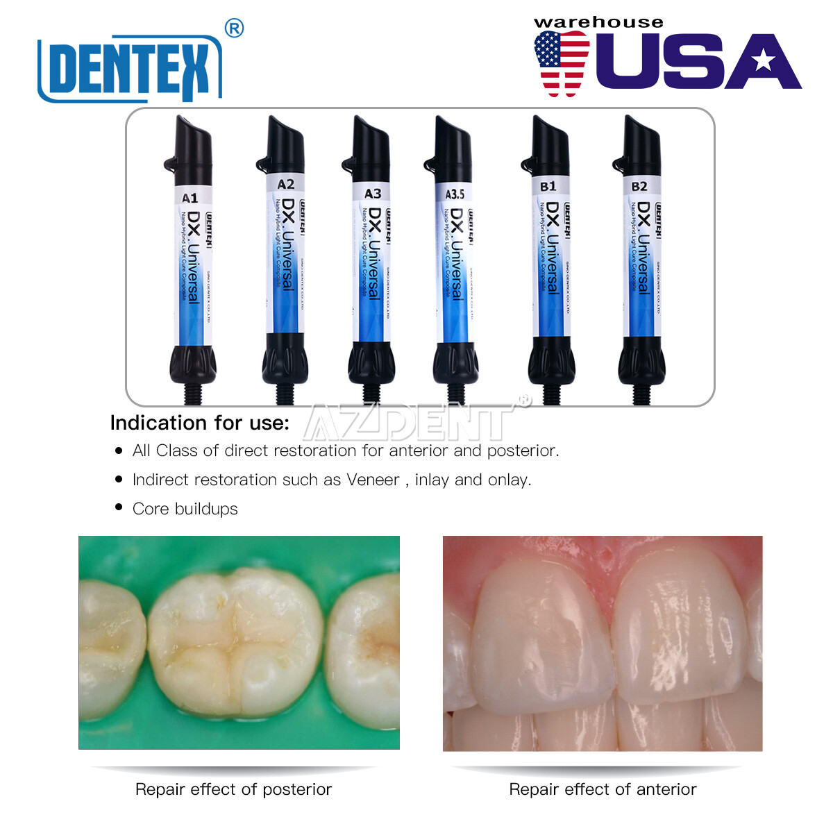 DX Dental Universal/Flowable Curing Light Composite Resin Shade A1 A2 A3 A3.5 B1