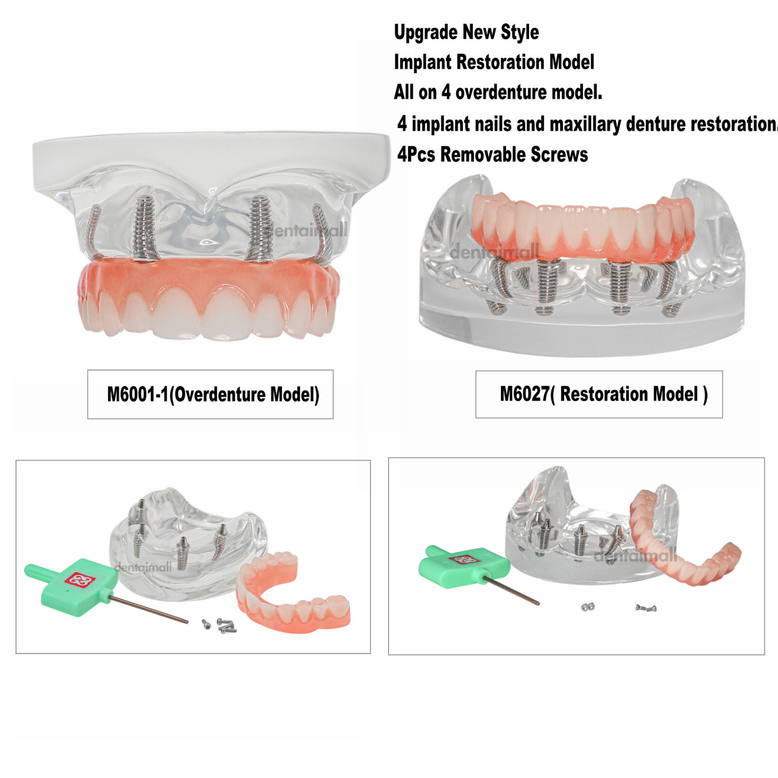 Dental Upper/Lower Jaw Type All on 4 Overdenture Modle With 4 Screws Restoration