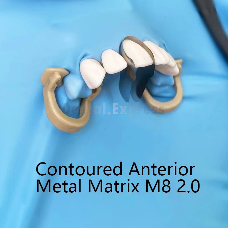 Dental Blue Proximal Strips Polyester Matrix Bands Metal Anterior Twin Matrices