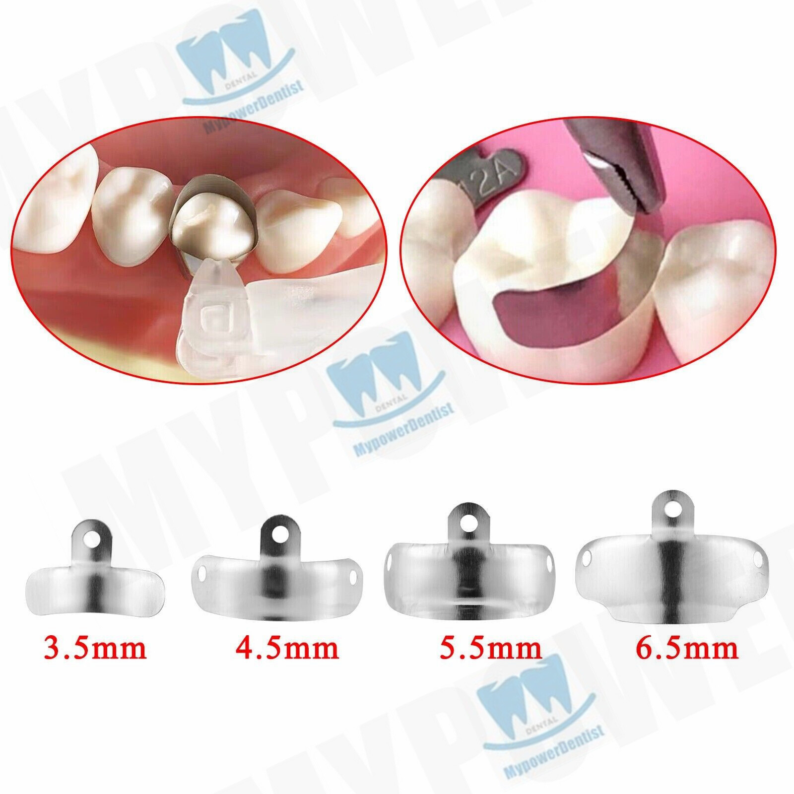 Dental Matrix Bands Ring Sectional Matrice Clamp Fit Palodent V3 System