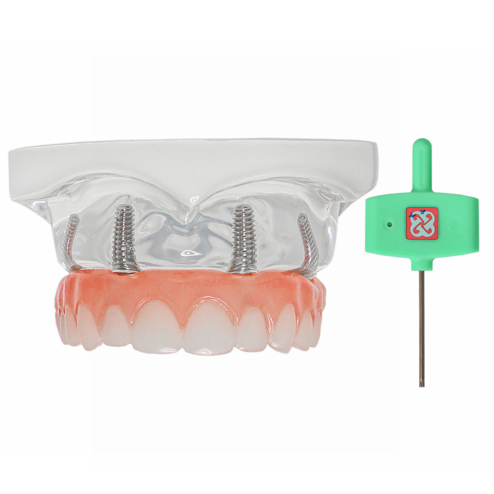 US Dental Overdenture Implant Model All-on-4 With 4 Screw Upper/Lower Clear Jaw