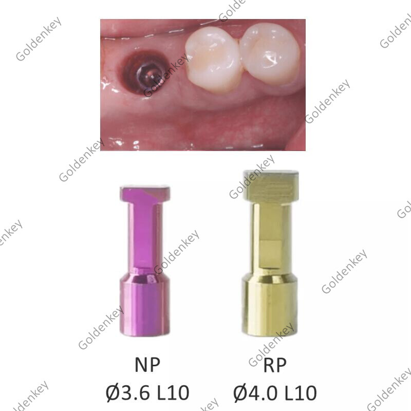 Dental Analog RP NP Compatible with Nob Bio care Active Abutment Fits for NOBel