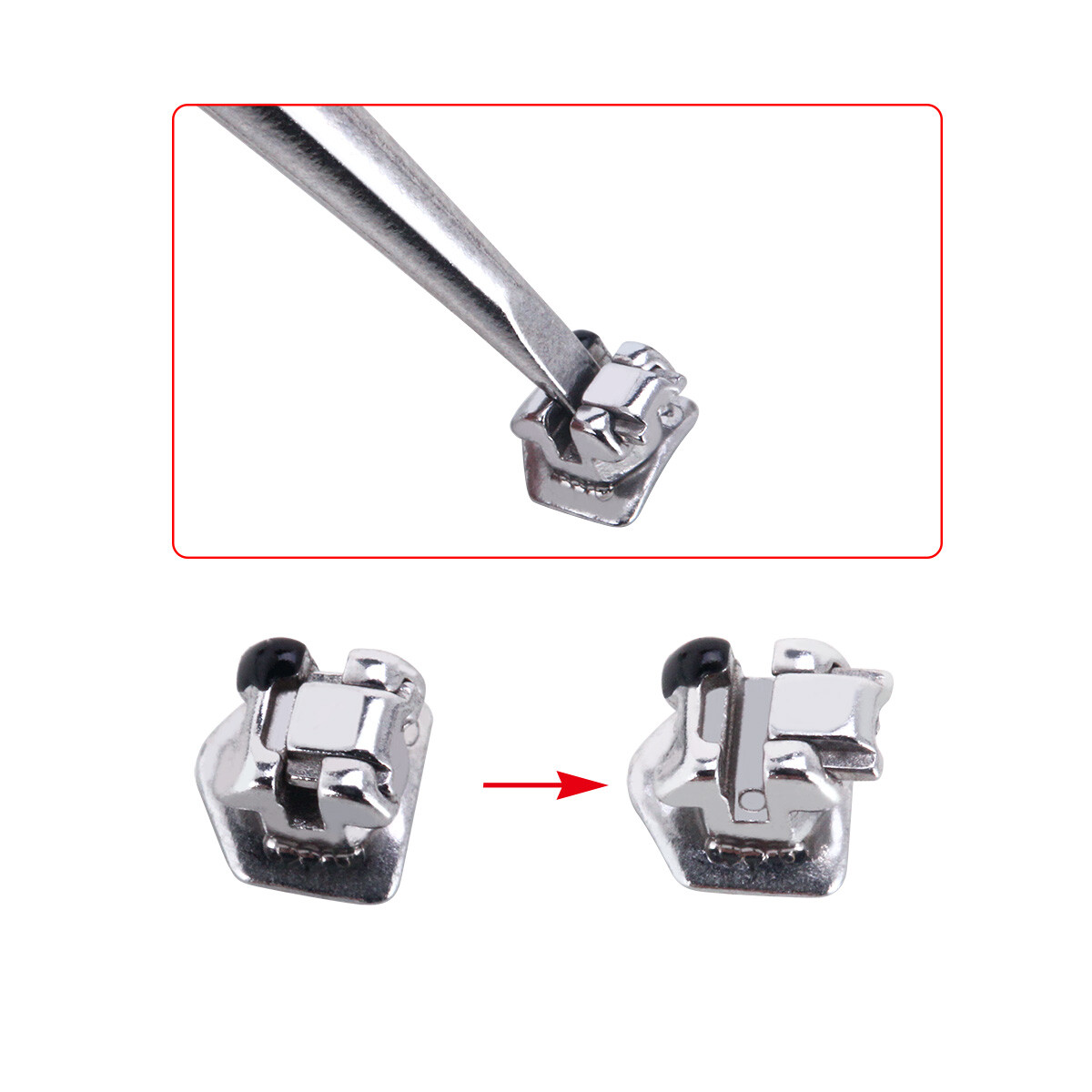 AZDENT Brackets de autoligado de ortodoncia dental Roth .022 Ganchos móviles 345