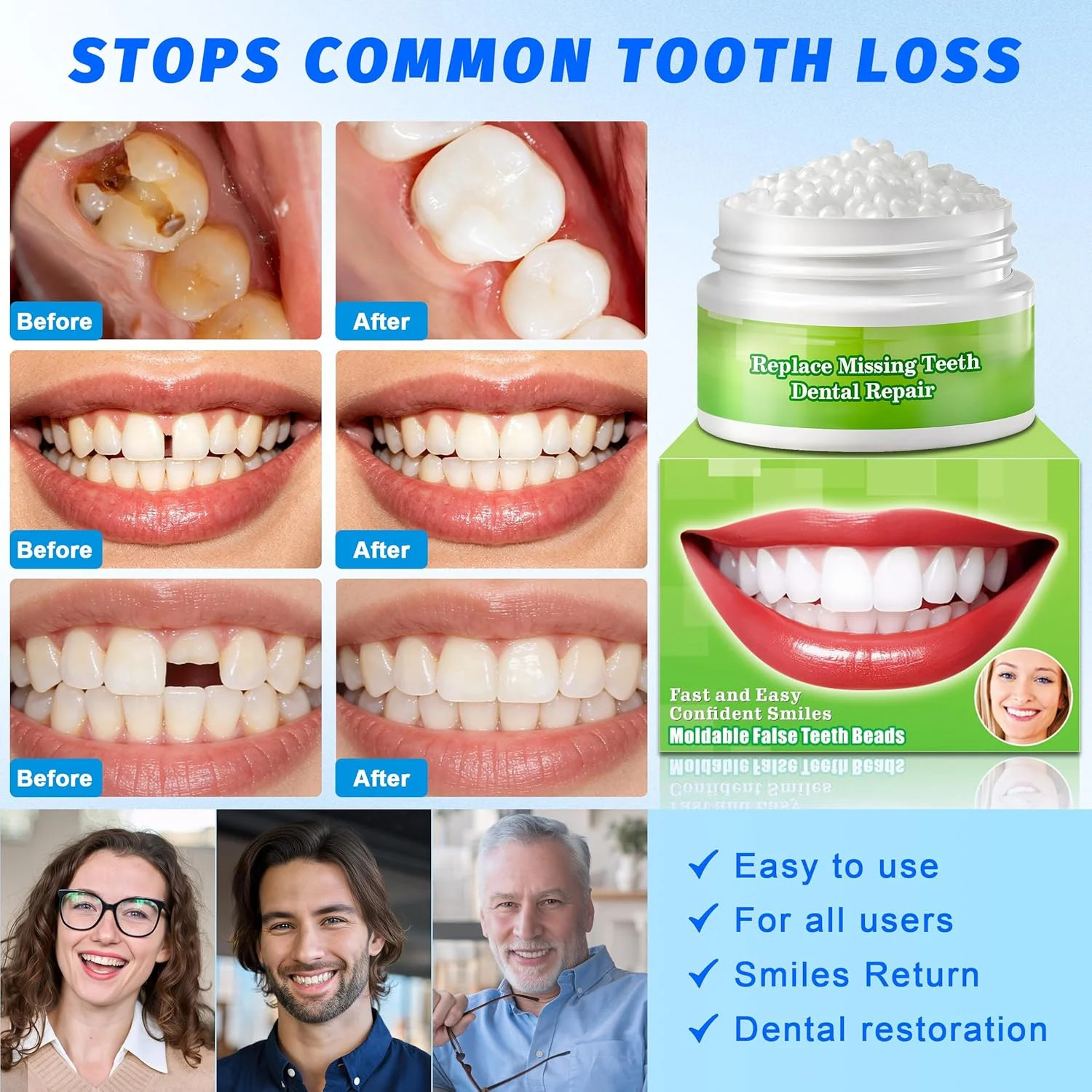 Tooth Repair Kit, Moldable False Teeth Beads | Fix Broken, Chipped, or Missing T