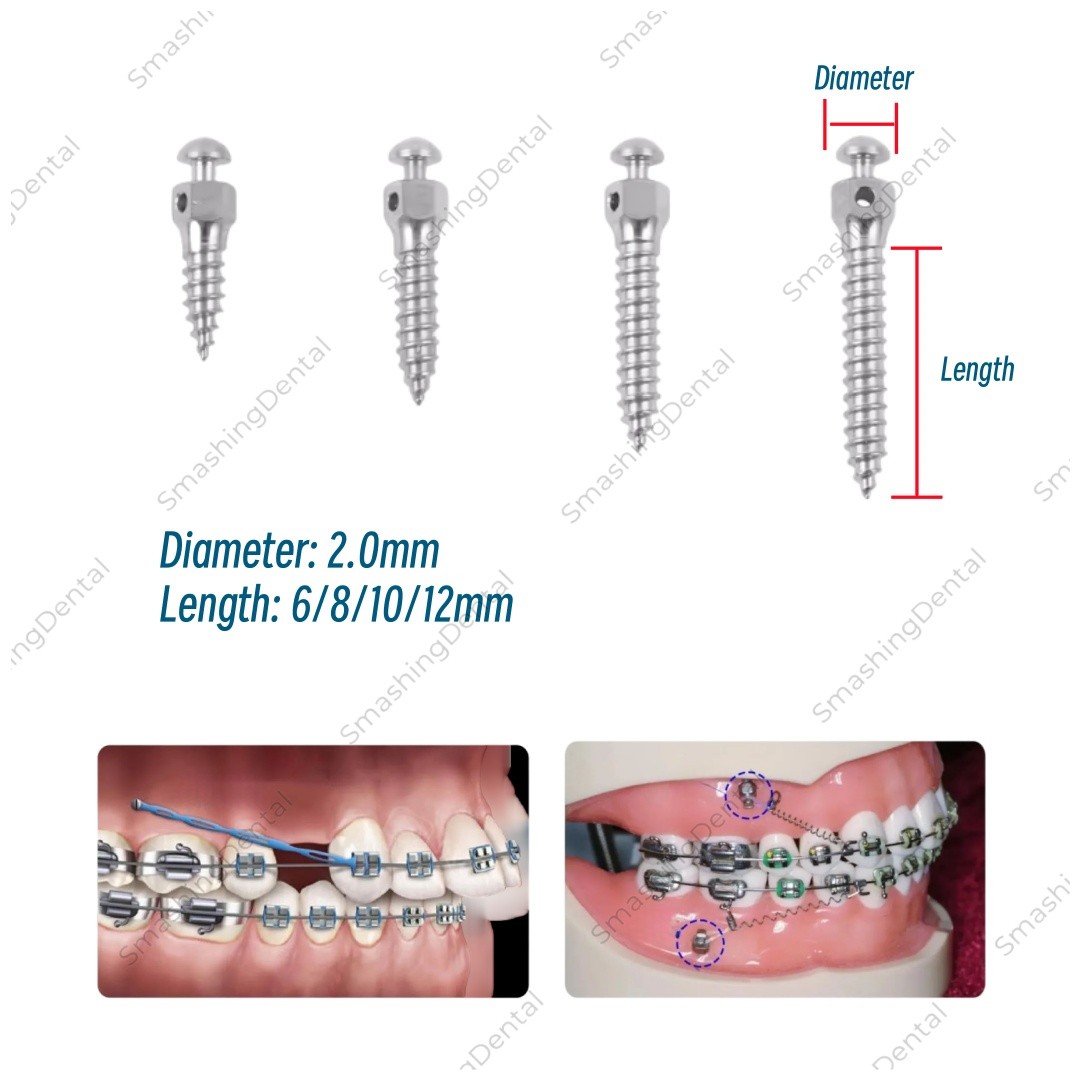 Dental Orthodontic Mini Implant Micro Screws Titanium TC4 Screw TAS Anchorage