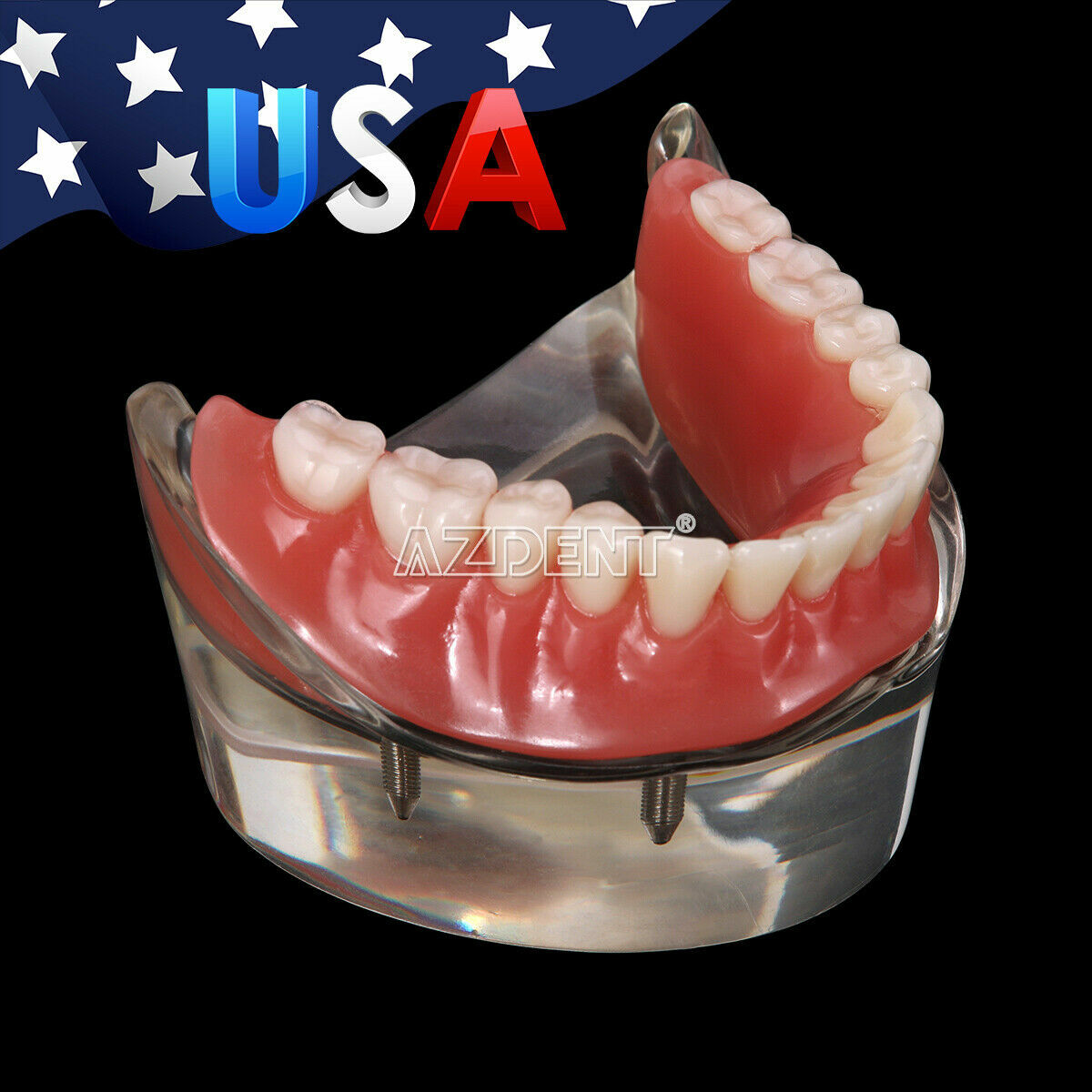 Dental Demonstration 4 Implants Teeth Model Typodont Inferior Overdenture Lower