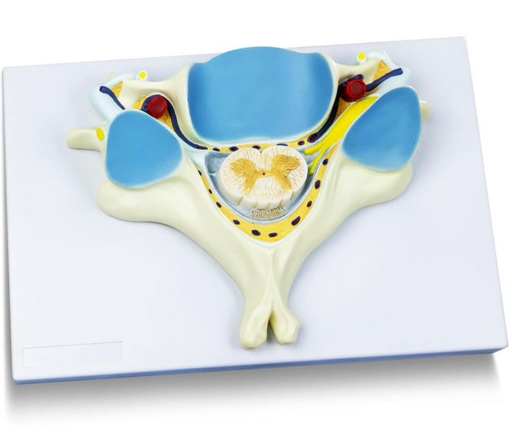 7X Enlarged Human 5th CERVICAL VERTEBRA Anatomical Teaching Model w/Spinal Cord