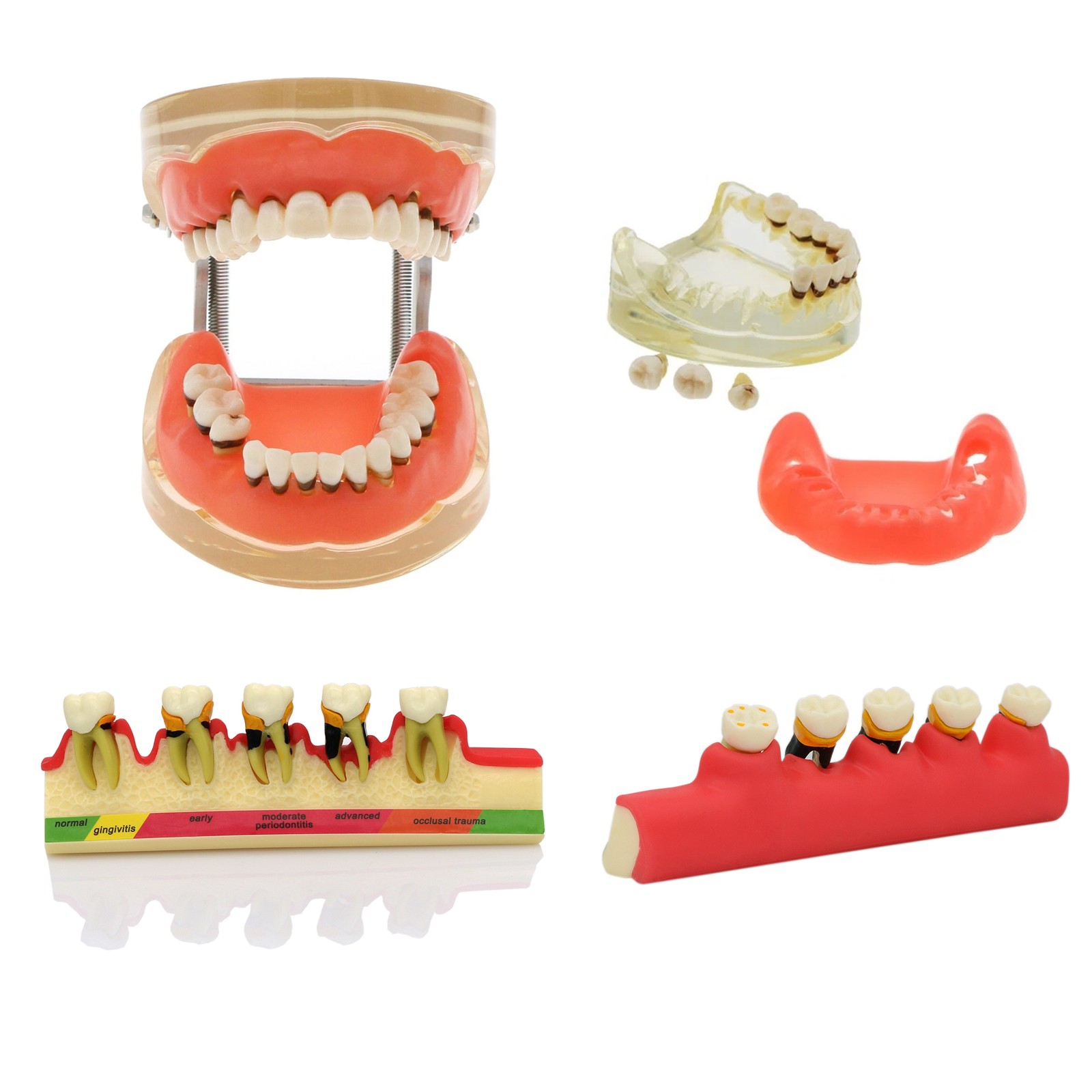 Multi-Type Dental Teaching Typodont Model Ortho/Implant/Pathology Practice Demo