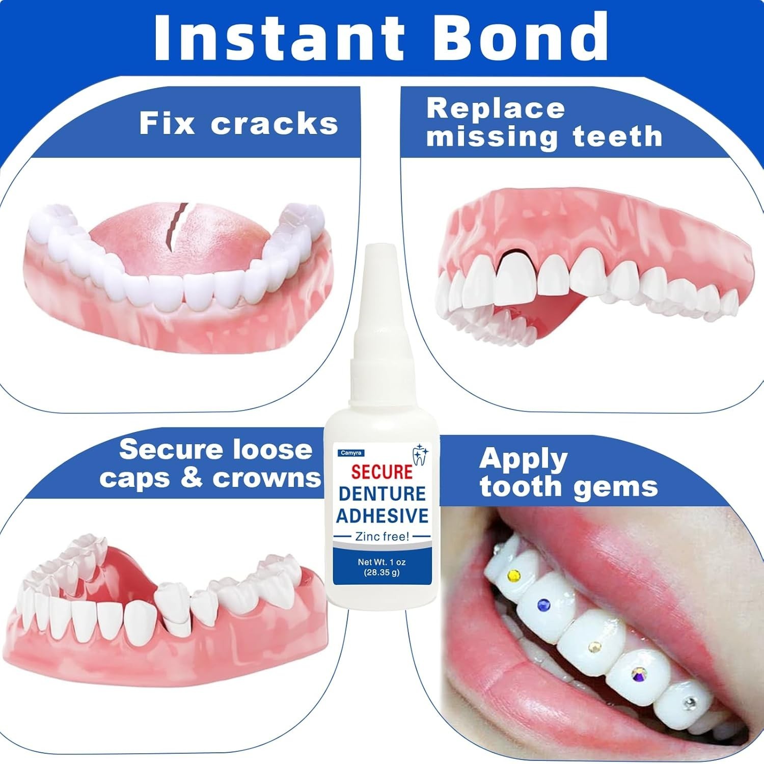 1oz, Repair Cracks & Secure Loose Teeth, Super-Strong Adhesive—Lasts Days to …