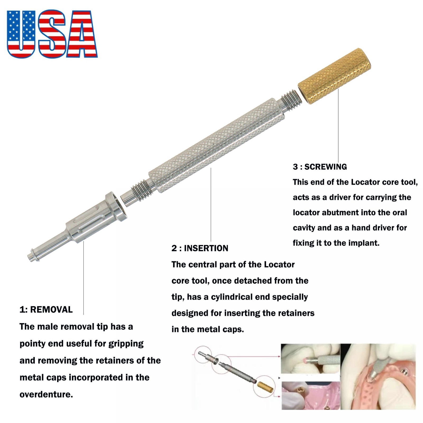 US For Hiossen Oss Implant Locator Abutments PEEK Retention Caps Mini & Regular
