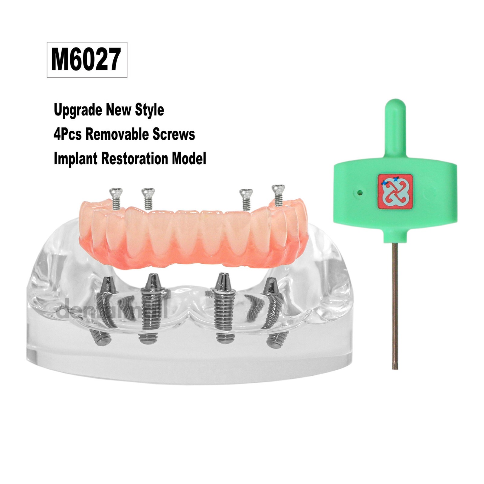 US Dental Overdenture Implant Model All-on-4 With 4 Screw Upper/Lower Clear Jaw