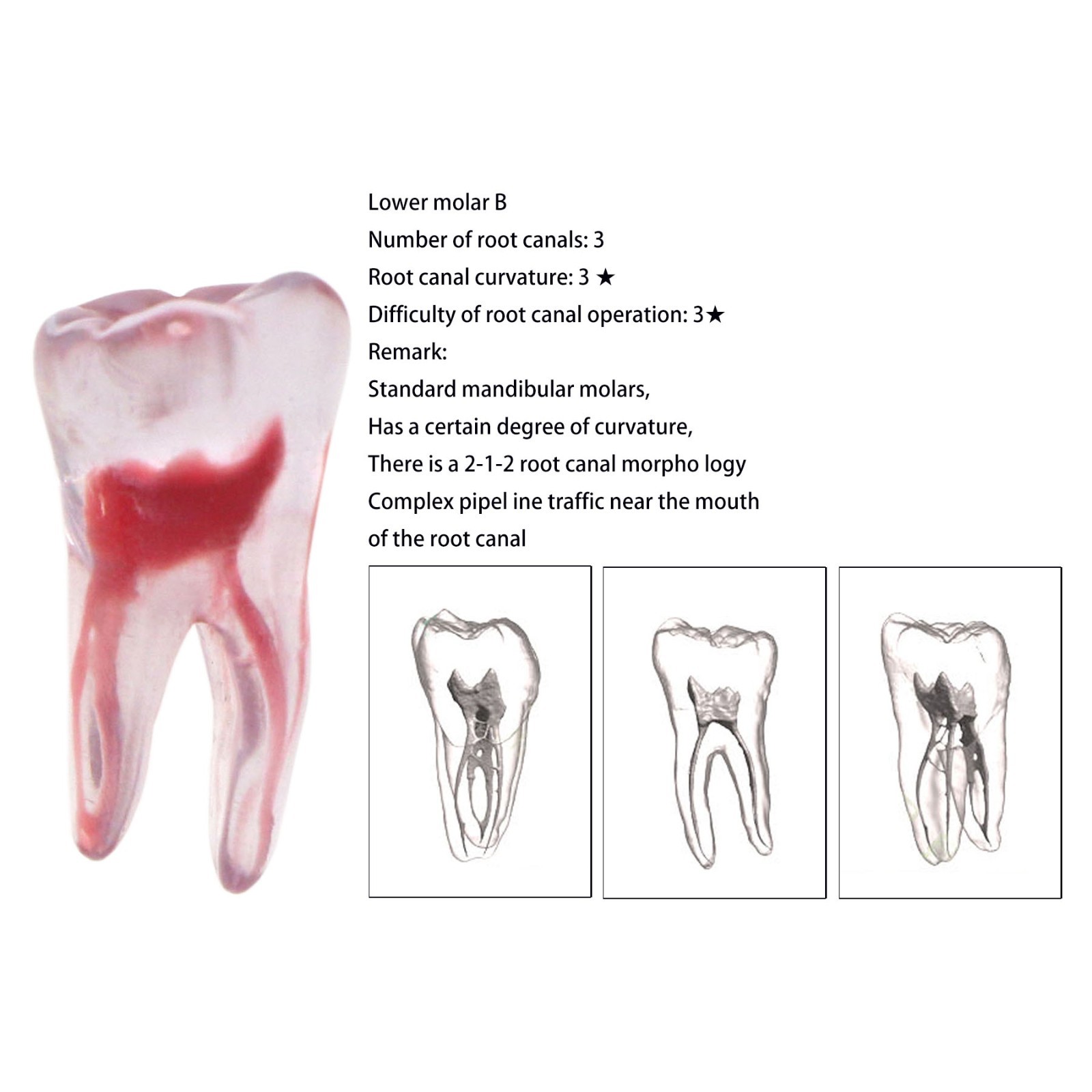 Dental Training 3D RCT Endo Tooth Model Practice Model Curved Root Resin Teeth