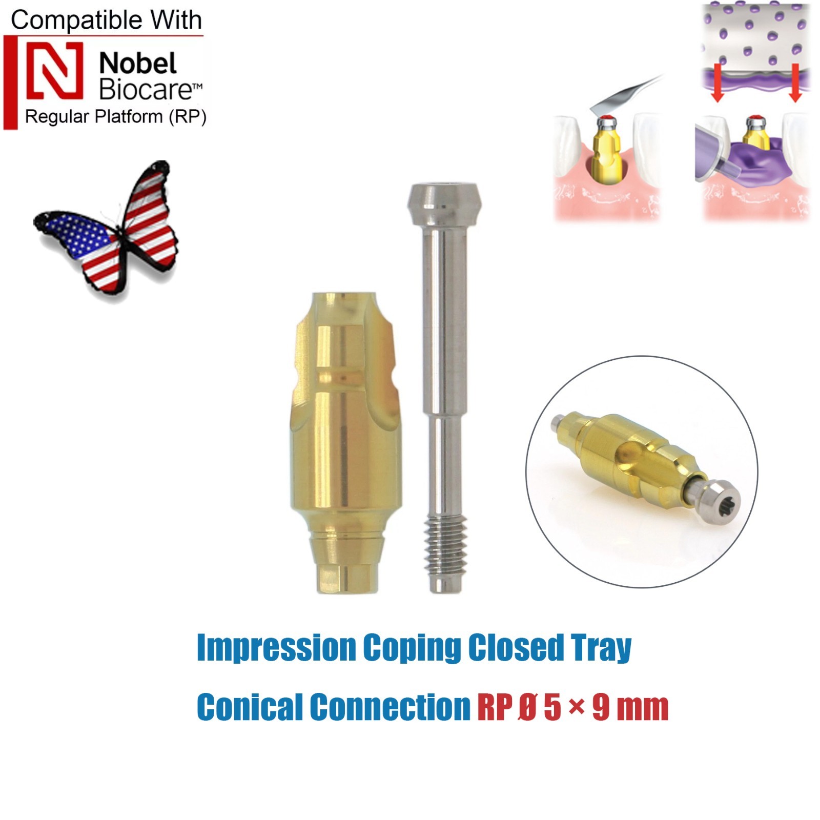 US Dental Nobel Biocare Open/Closed Tray Impression Coping/Analog/Scanbody NP RP