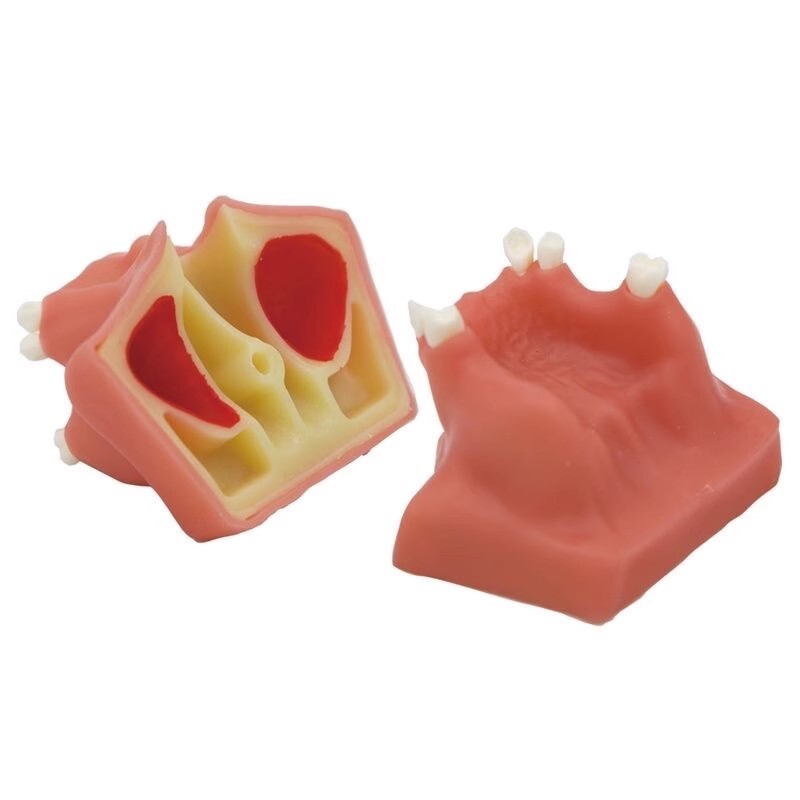 Dental Maxillary Sinus Lift Model Typodont Practice Model TYPE A/B
