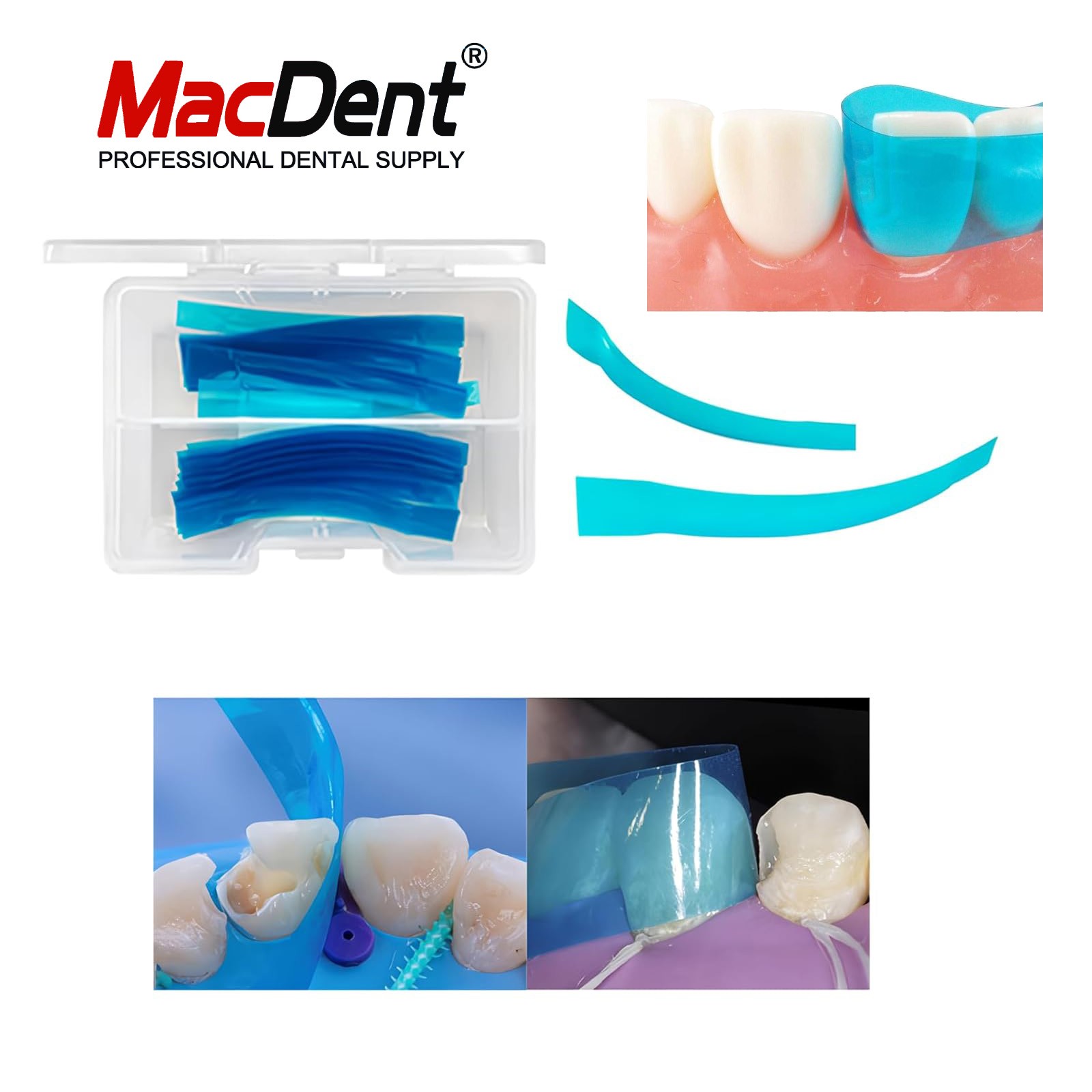 Dental Matrix Bands Sectional Contoured Twin Matrices Proximal Anterior Strips