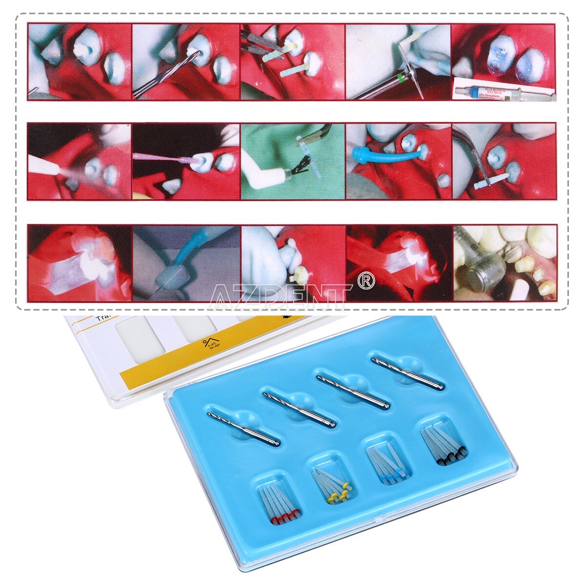 Dental Endodontic Fiber Posts Kit 1.2mm 1.4mm 1.6mm 1.8mm +4Pcs Drills