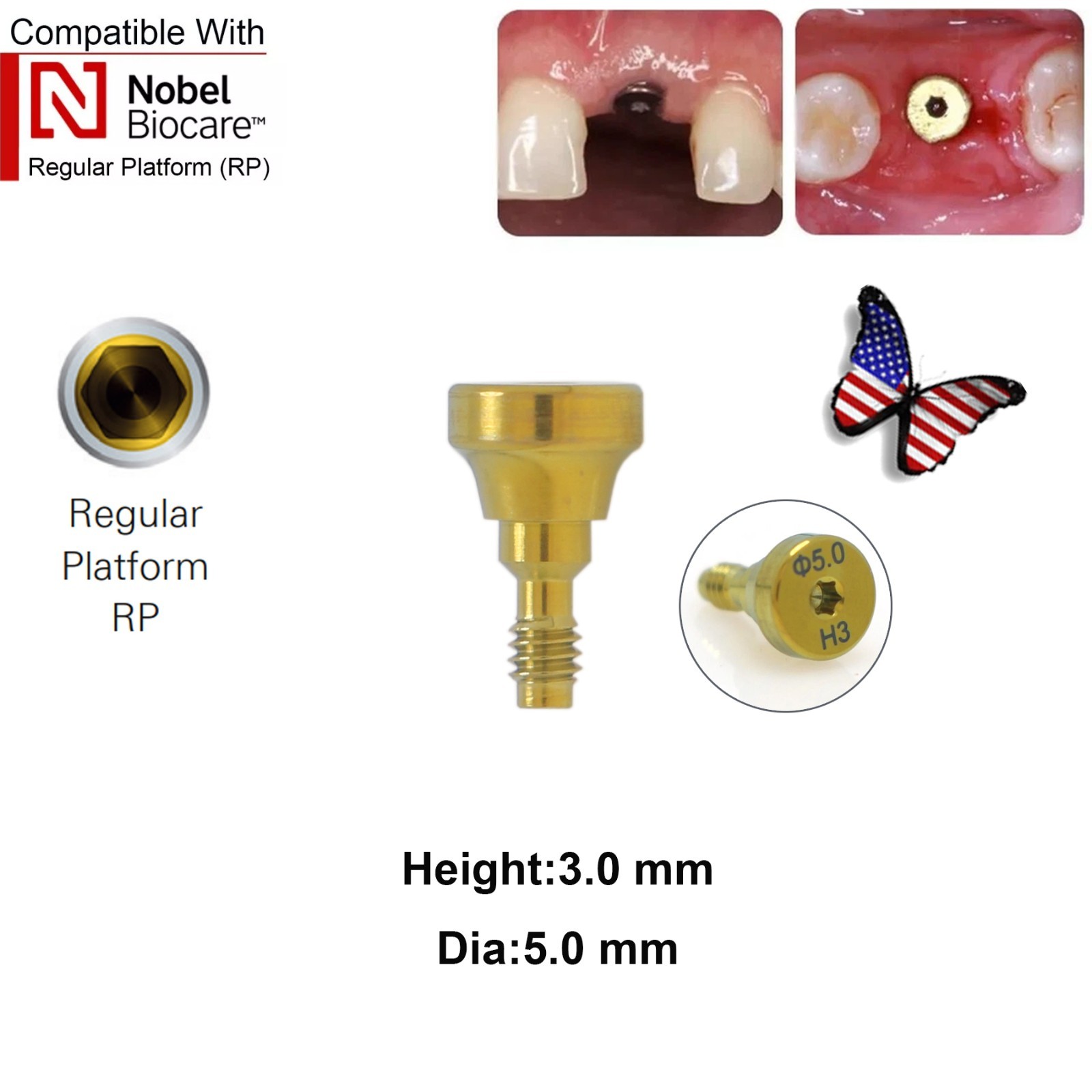 5Pcs Nobel active Healing Abutment Cover Screw Healing Screw Gum Molding Implant