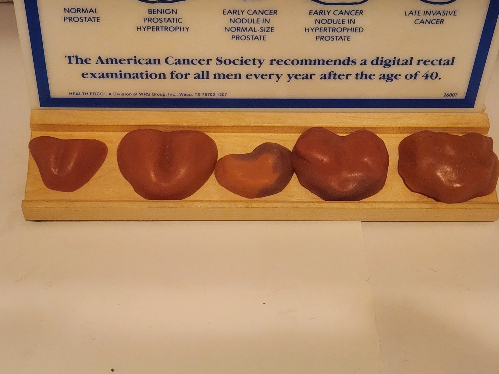 Prostate exam chart and touch