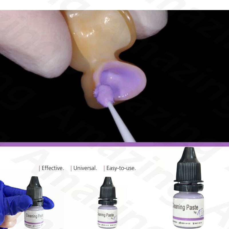 Dental Cleaning Paste Clean Bonding Surfaces After Try-in Ivoclean Crowns Veneer