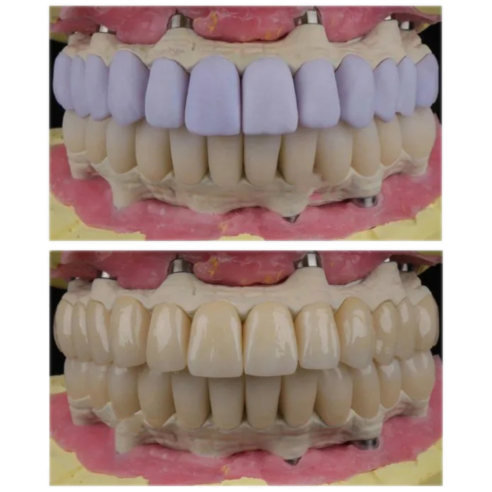 Dental C14 Glass Ceramic Block HT LT Emax Lithium Disilicate for CEREC CAD/CAM