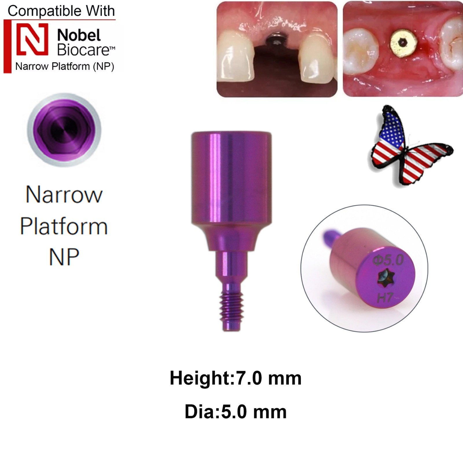 5Pcs Nobel active Healing Abutment Cover Screw Healing Screw Gum Molding Implant