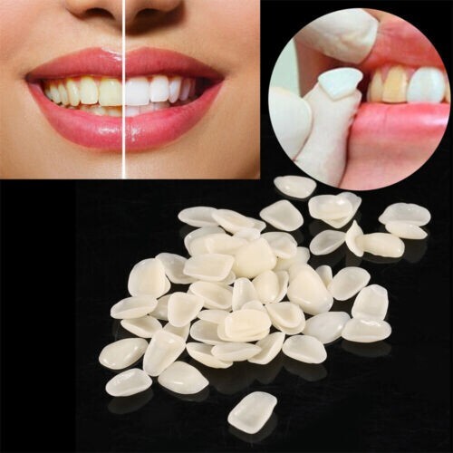 140Pcs Dental Veneers Upper Anterior Mixed Ultra-Thin Resin Teeth Whitening A1