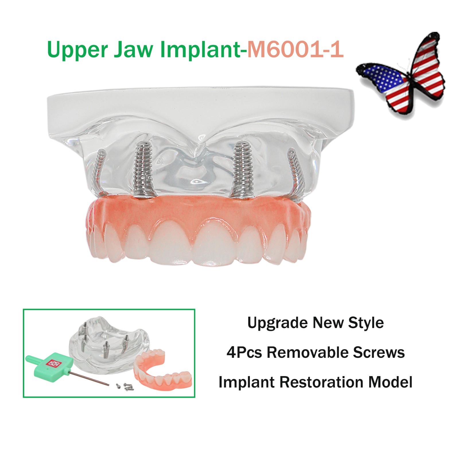 US Dental Upper/Lower 4 Implants Demo Teeth Model – Restoration Overdenture