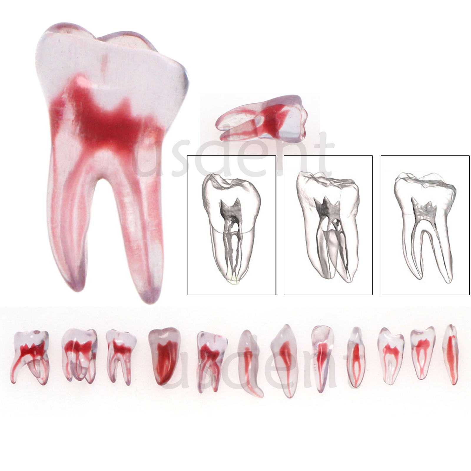 Dental Training 3D RCT Endo Tooth Model Practice Model Curved Root Resin Teeth