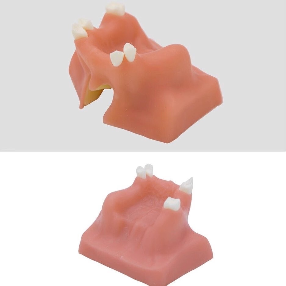 Dental Maxillary Sinus Lift Model Typodont Practice Model TYPE A/B