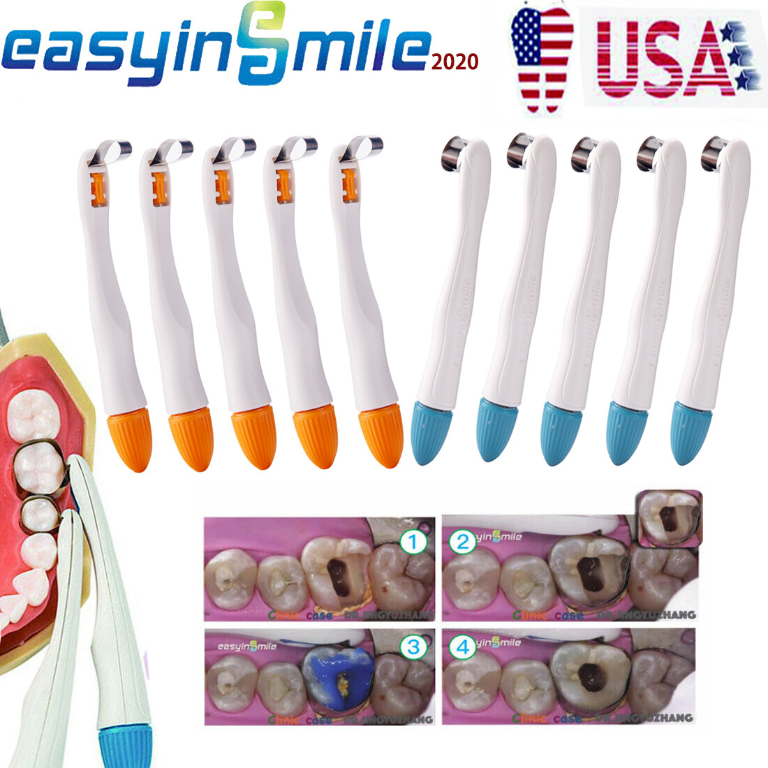 10pcs Dental Pro Metal Matrix Bands Molar/Premolar Restoration Band Adjustable