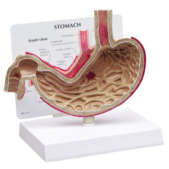 Stomach GPI Anatomical Model w Ulcer LFA #2000. Make Us an Offer! SEE VIDEO