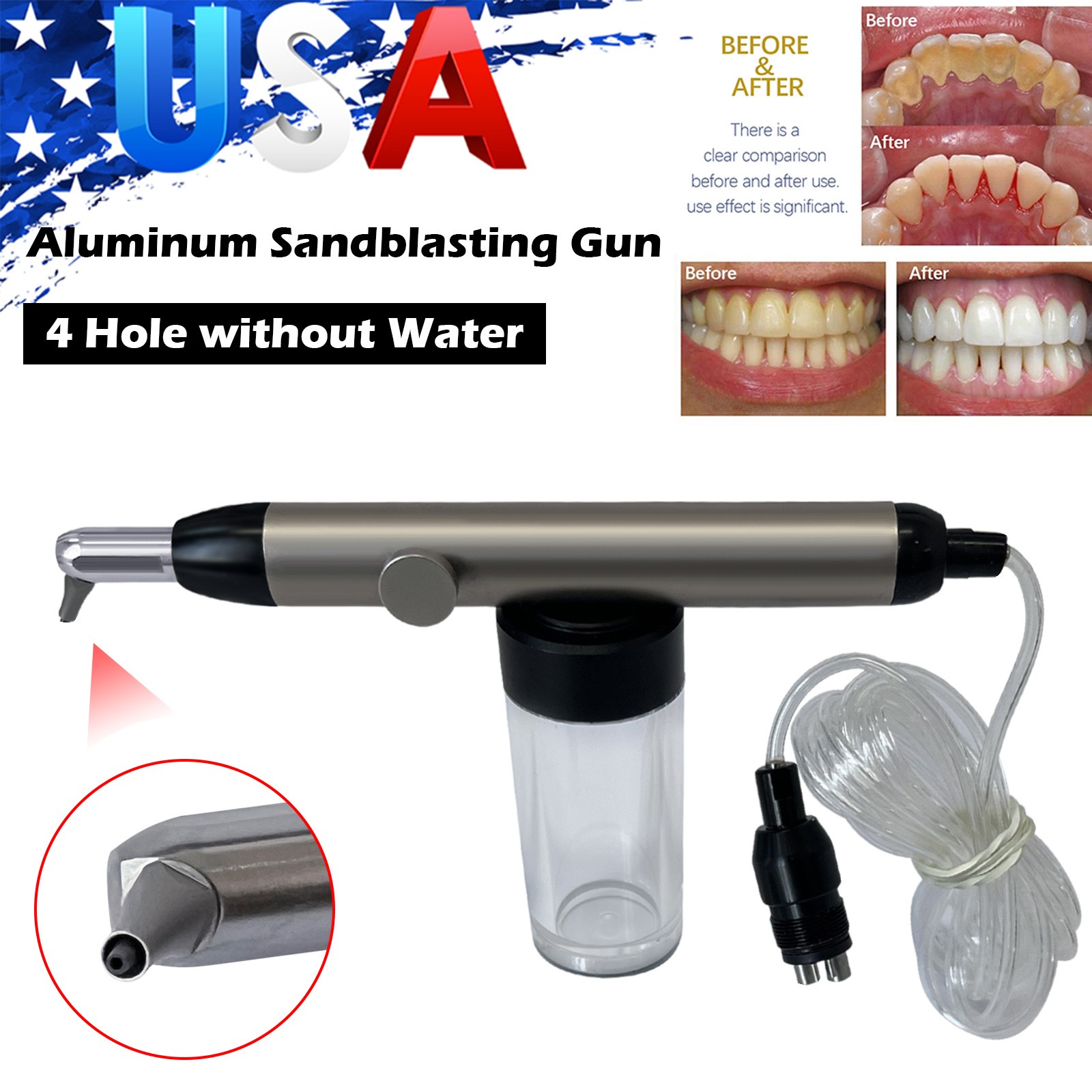 Dental Alumina Air Abrasion Polisher Microetcher Sandblasting Gun 4Hole New