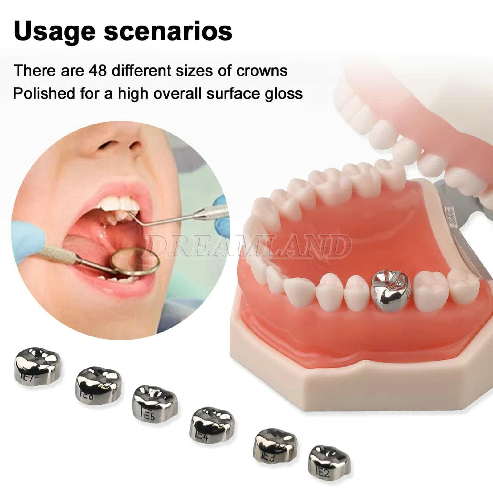 48 ASSORTED PRIMARY MOLAR STAINLESS STEEL CROWNS – COMPLETE KIT