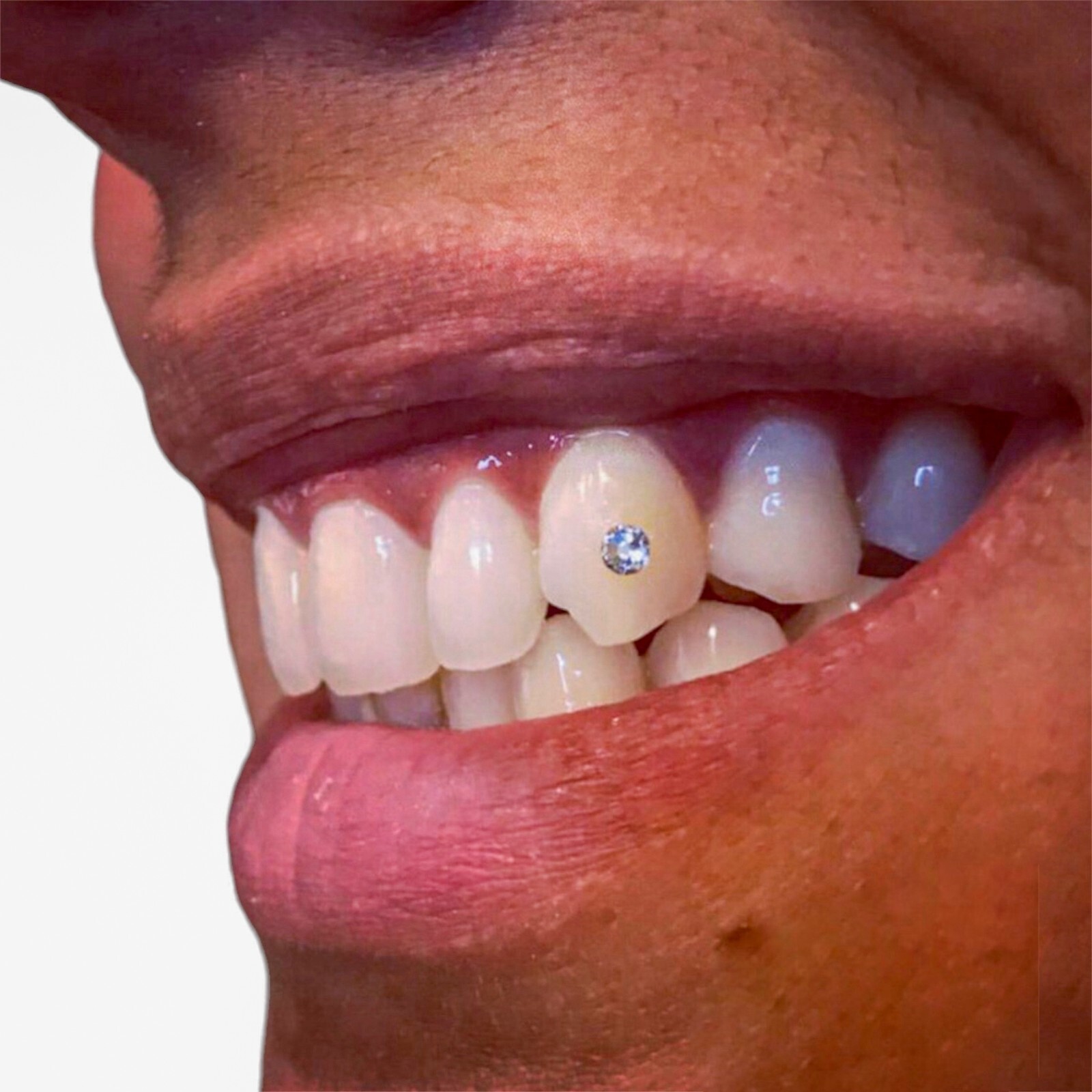 SparkleBites Professional Tooth Gem Kit. Strong tooth gem glue and tooth bonding