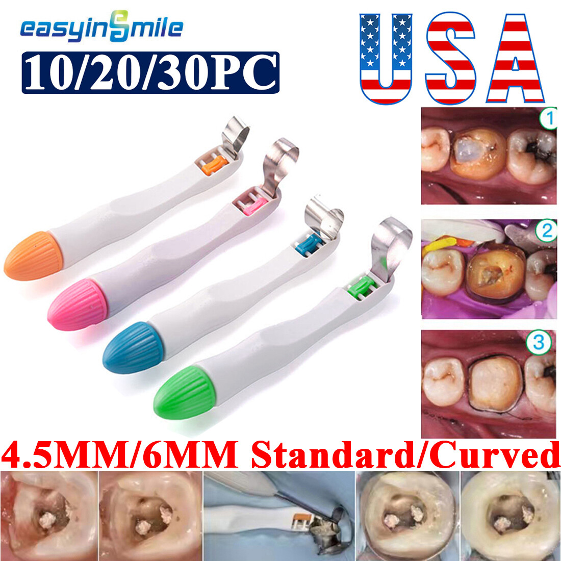 Dental Pro Metal Matrix Bands Molar/Premolar pre formed Bands Restoration Adjust