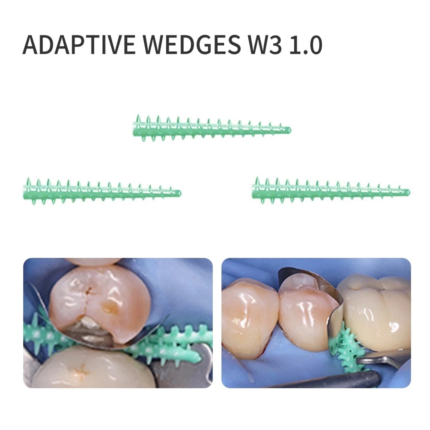 Dental Coating Matrix Bands Matrices NITI Pediatric Clamp Ring Adaptive Wedges