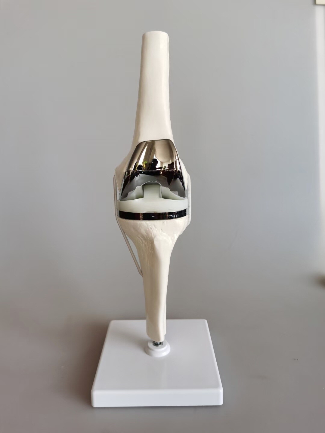 Detachable Artificial Knee Prosthesis Medical Anatomical Teaching Demo Model