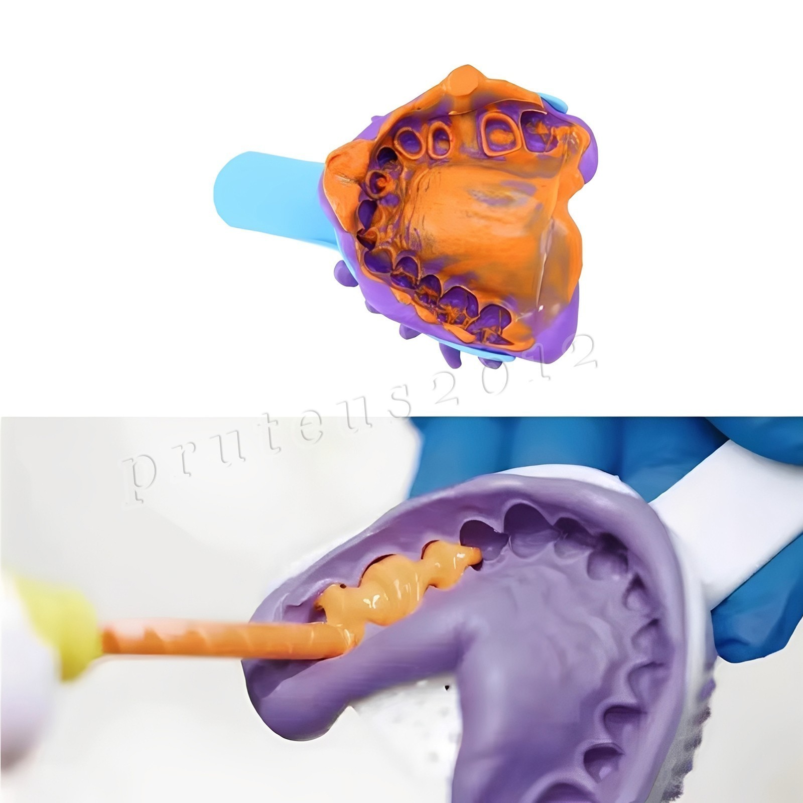 Dental Impression Material VPS Light Body Fast Set (2 Cartridge & 10 Tips)PVS