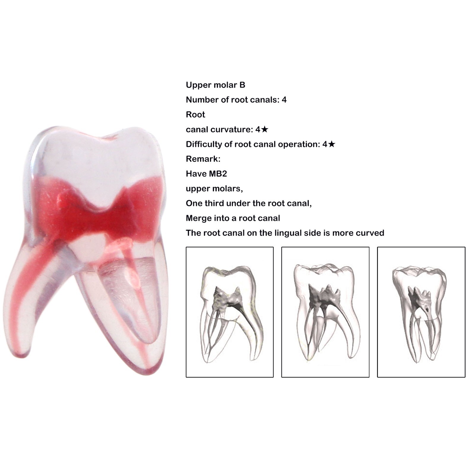 Dental Training 3D RCT Endo Tooth Model Practice Model Curved Root Resin Teeth