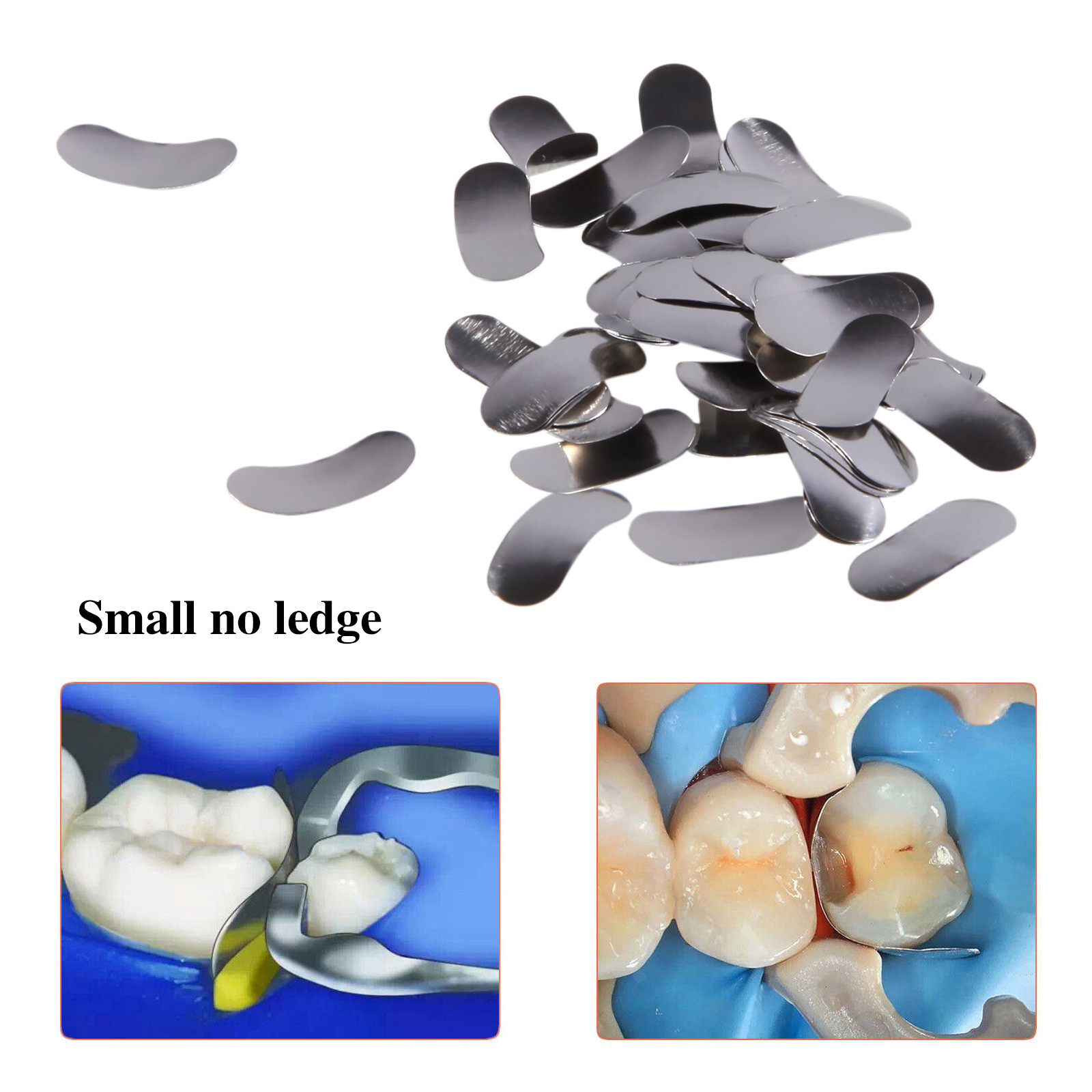 50Pcs Dental Metal Matrices Matrix Band Sectional Contoured Refill S/M/L 35μm DL
