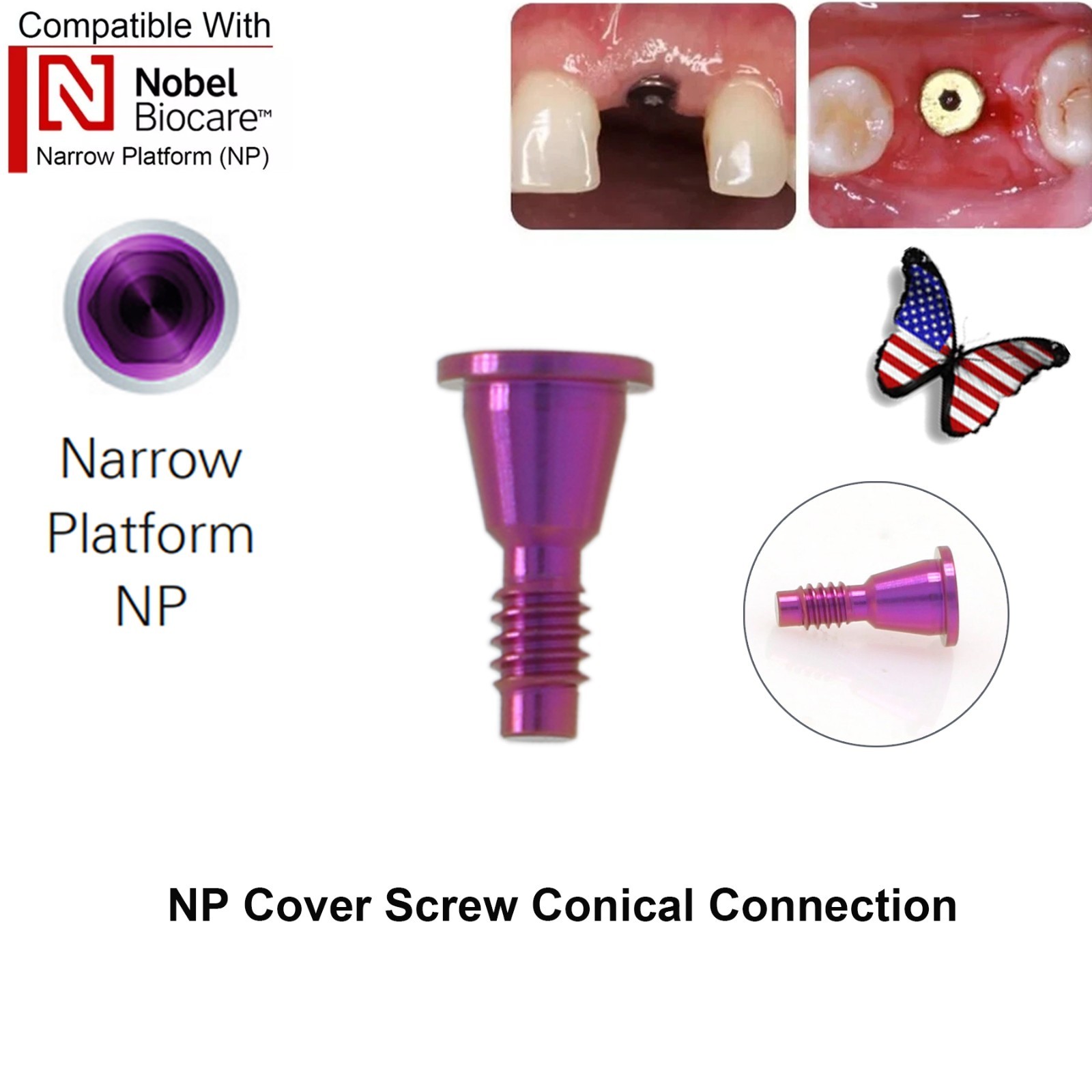 5Pcs Nobel active Healing Abutment Cover Screw Healing Screw Gum Molding Implant