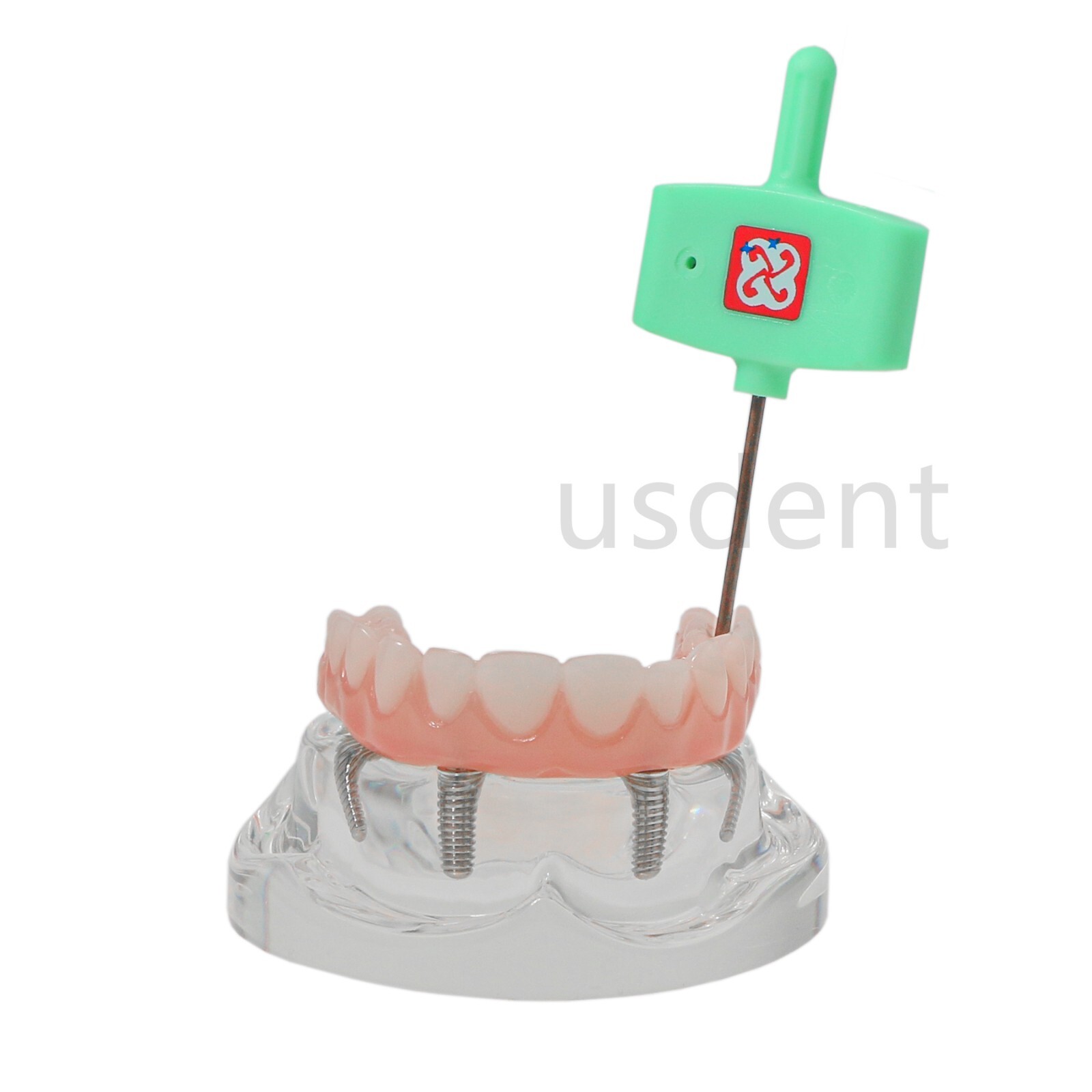 All on 4 Dental Implant Model Overdenture Upper Jaw 4 Implant Clear Detachable