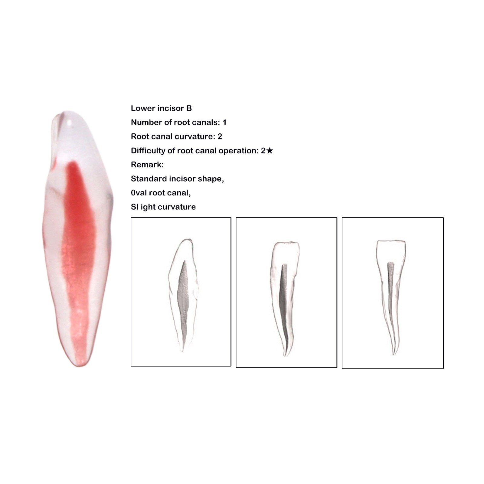 Dental Training 3D RCT Endo Tooth Model Practice Model Curved Root Resin Teeth