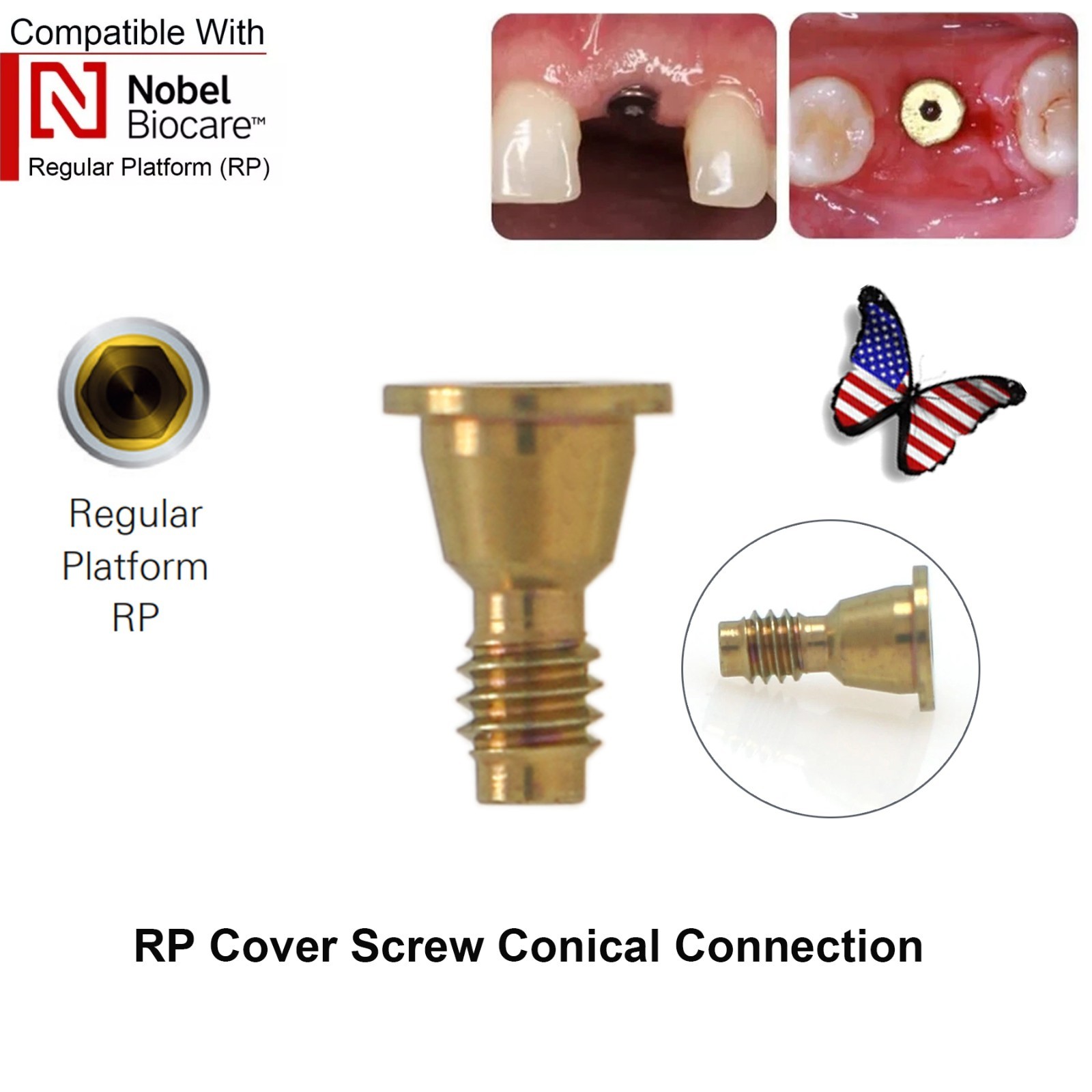5Pcs Nobel active Healing Abutment Cover Screw Healing Screw Gum Molding Implant