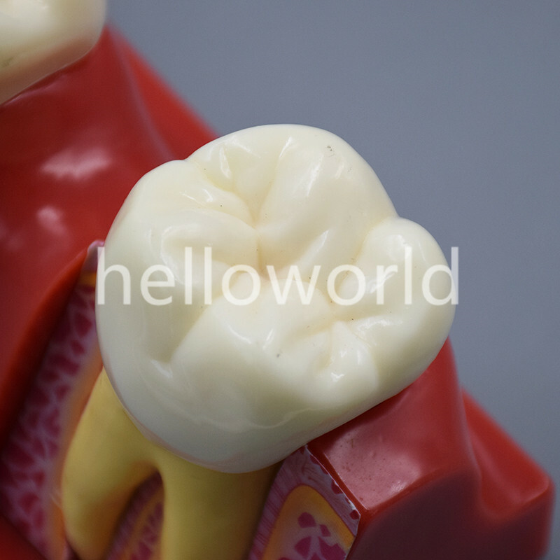 Dental Endodontic Study Teeth Model 4 Times Tooth Anatomy Anatomical Models